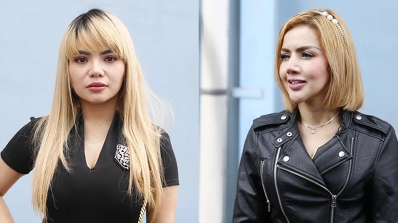 Dituduh Tonjok Hidung Barbie Kumalasari, Dinar Candy: Stop Halu