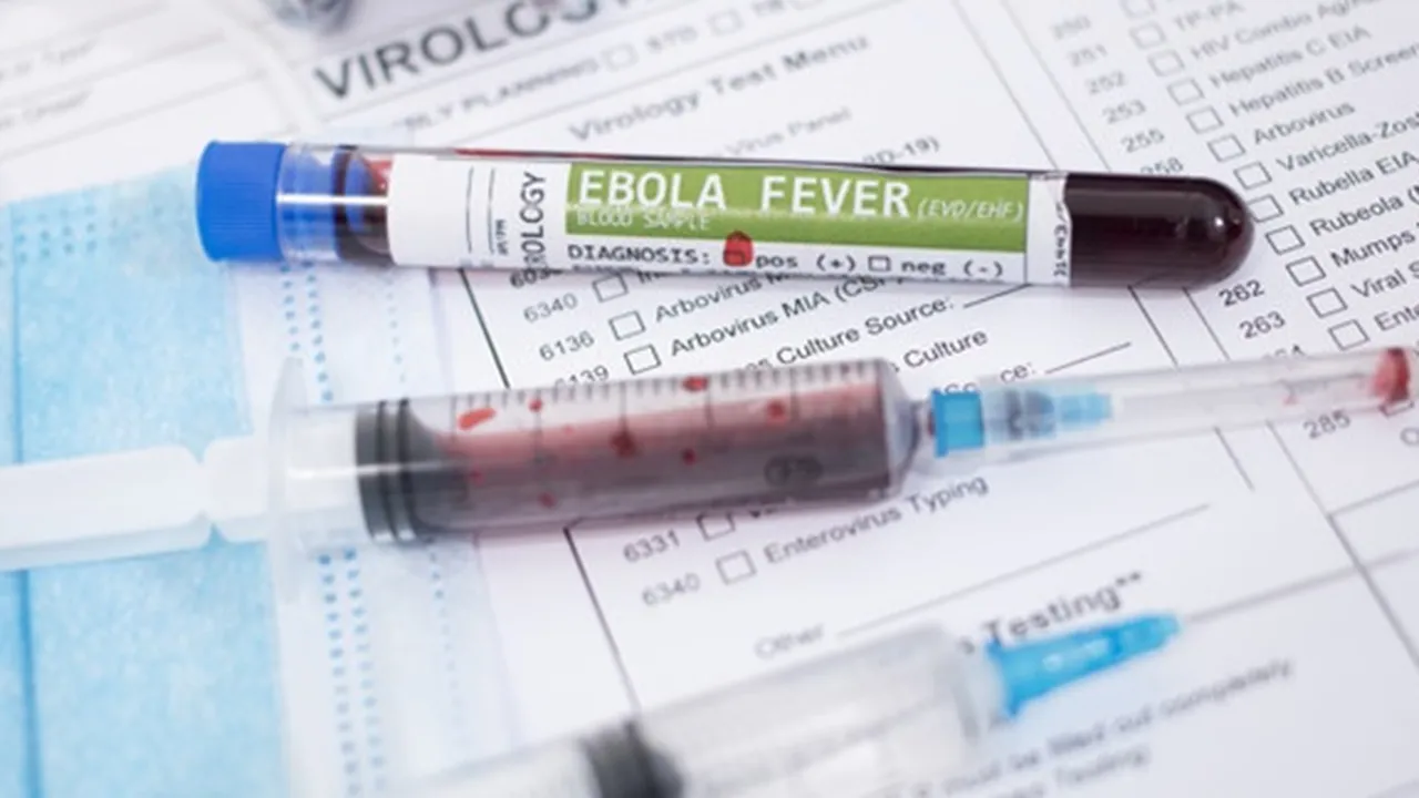Ebola Adalah Penyakit Akibat Virus Mematikan, Ketahui Gejala dan Cara Penularannya