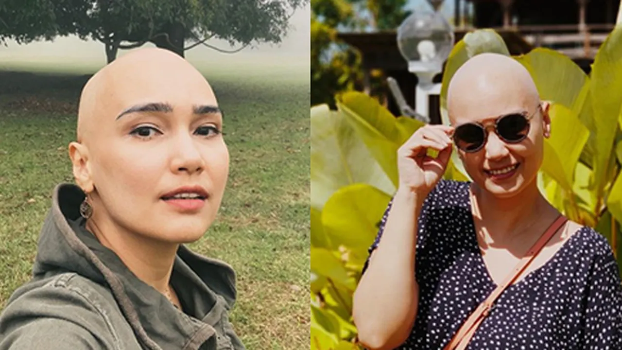 Feby Febiola Ungkap Penyakitnya, Kanker Ovarium Stadium 1C