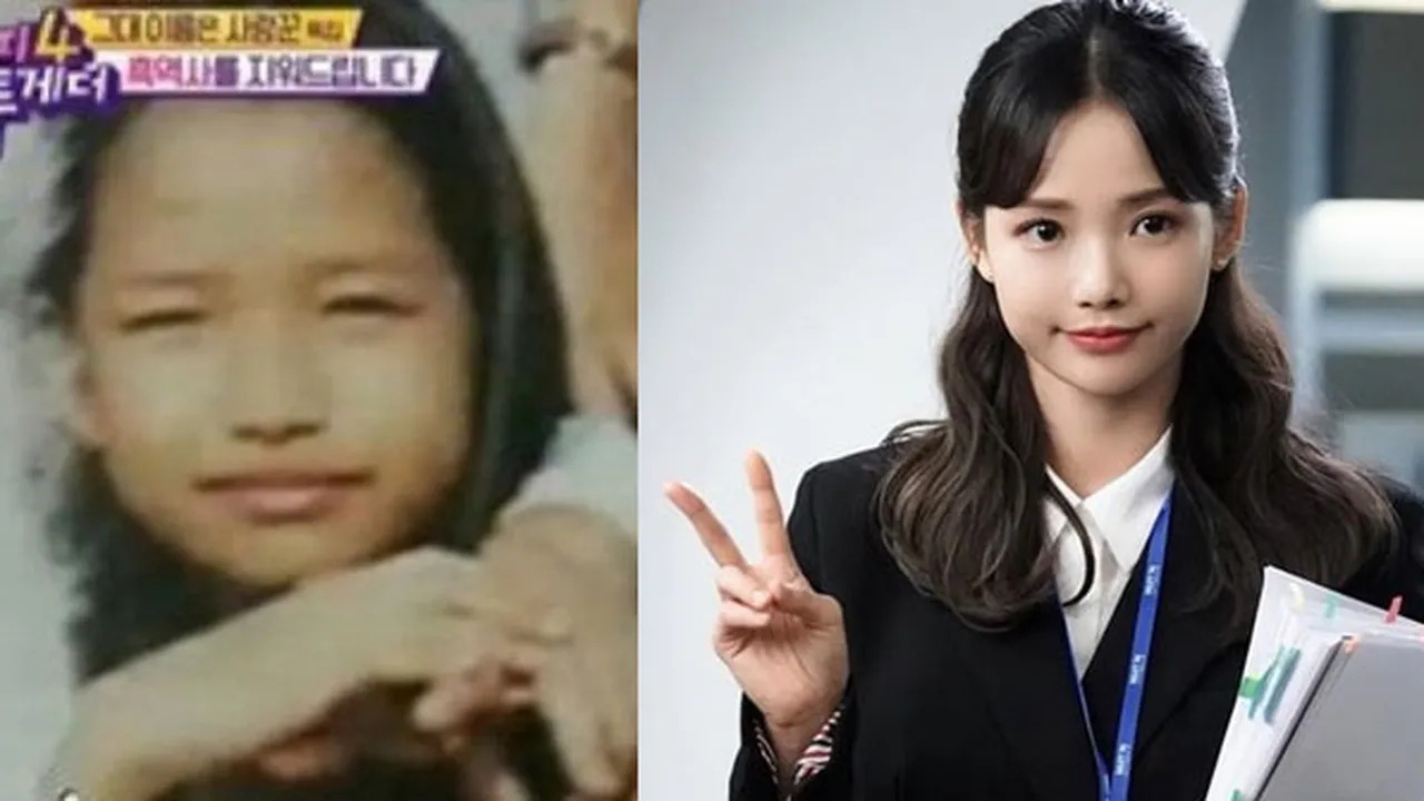 Foto Masa Kecil Beredar, Ha Yeon Soo Bantah Lakukan Operasi Plastik