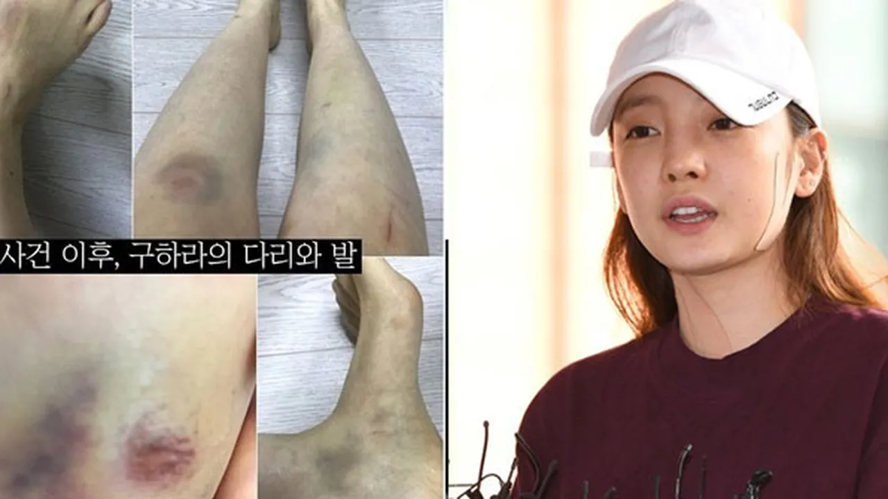 Hadiri Panggilan Polisi, Goo Hara Berikan Penjelasan Langsung Soal Kasus Penganiayaan Hadiri Panggilan Polisi, Goo Hara Berikan Penjelasan Langsung Soal Kasus Penganiayaan