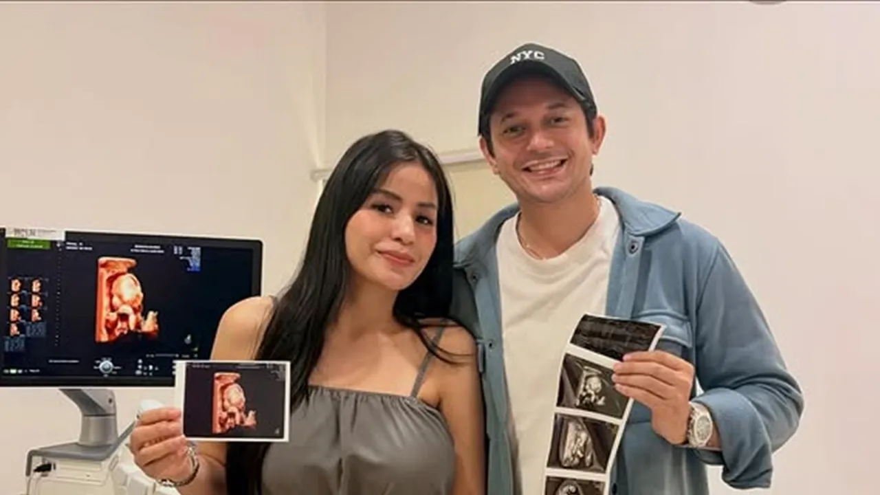 Hamil 6 Bulan, Vio Cerita Ngidam dan Perhatian Andrew Andika