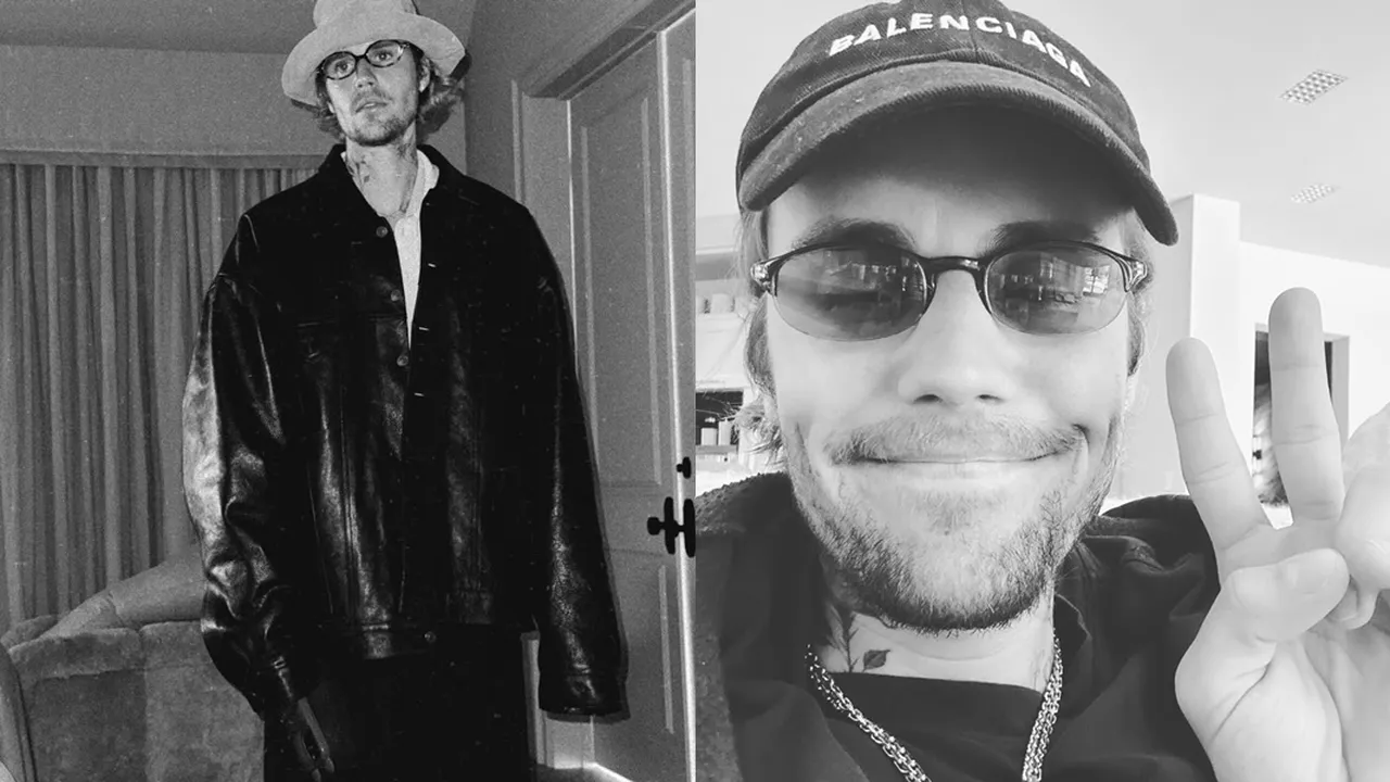 Justin Bieber Angkat Bicara Setelah Fans Mulai Khawatirkan Kesehatannya