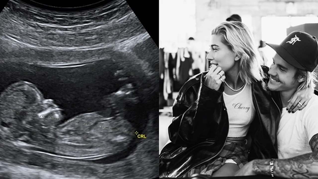 Justin Bieber Unggah Foto Hasil USG, Hailey Baldwin Hamil?