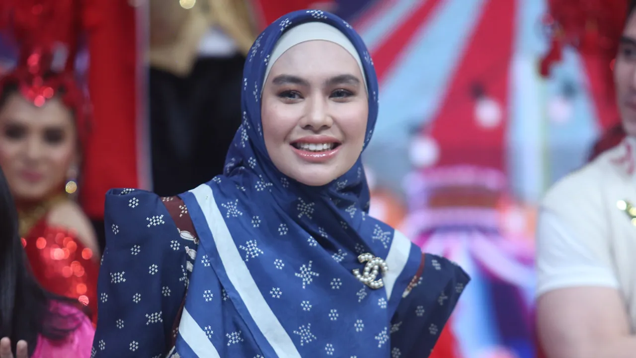 Kartika Putri Tetap Percaya Diri Meski Idap Penyakit Stevens-Johnson Syndrome
