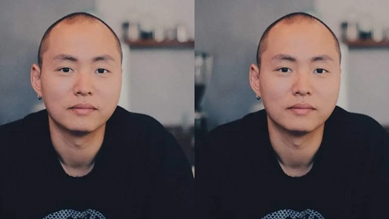 Kecelakaan di Thailand & Lumpuh, Rapper KK Minta Bantu Dana Untuk Pulang ke Korea