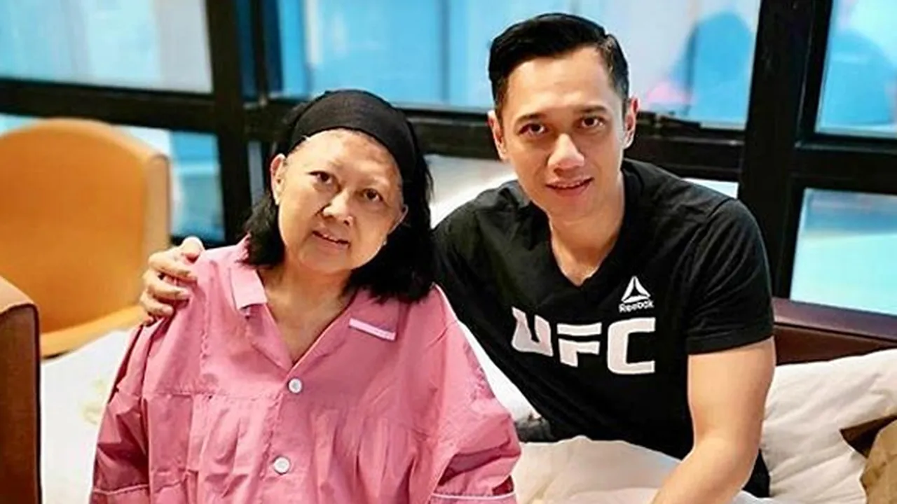 Kondisi Terbaru Ani Yudhoyono di RS, Wajah Berubah Drastis