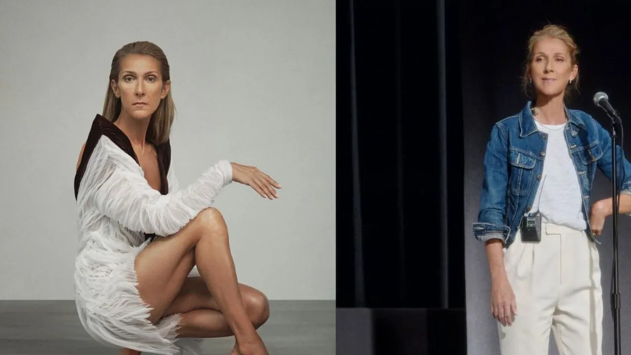 Kondisi Terkini Celine Dion, sedang Kena Penyakit Langka