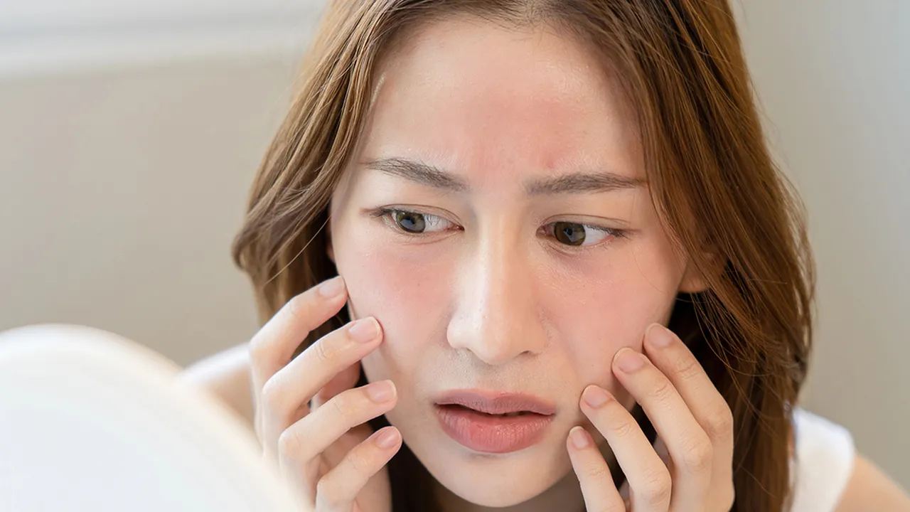 Kulit Wajah Mendadak Rewel? Kenali Tanda Skin Barrier Rusak dan Cara Ampuh Mengatasinya