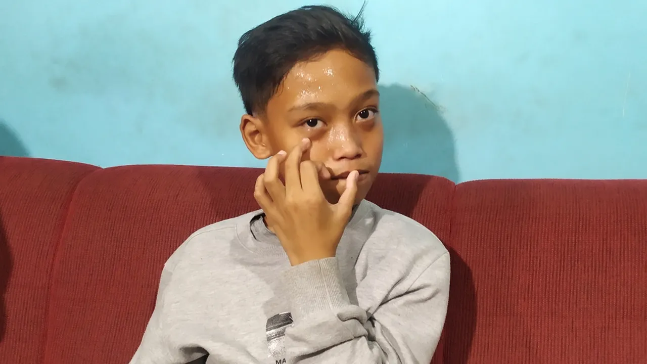Masih Ngilu, Korban Tragedi Kanjuruhan Jatuh Timpa Kerumunan di Gate 12