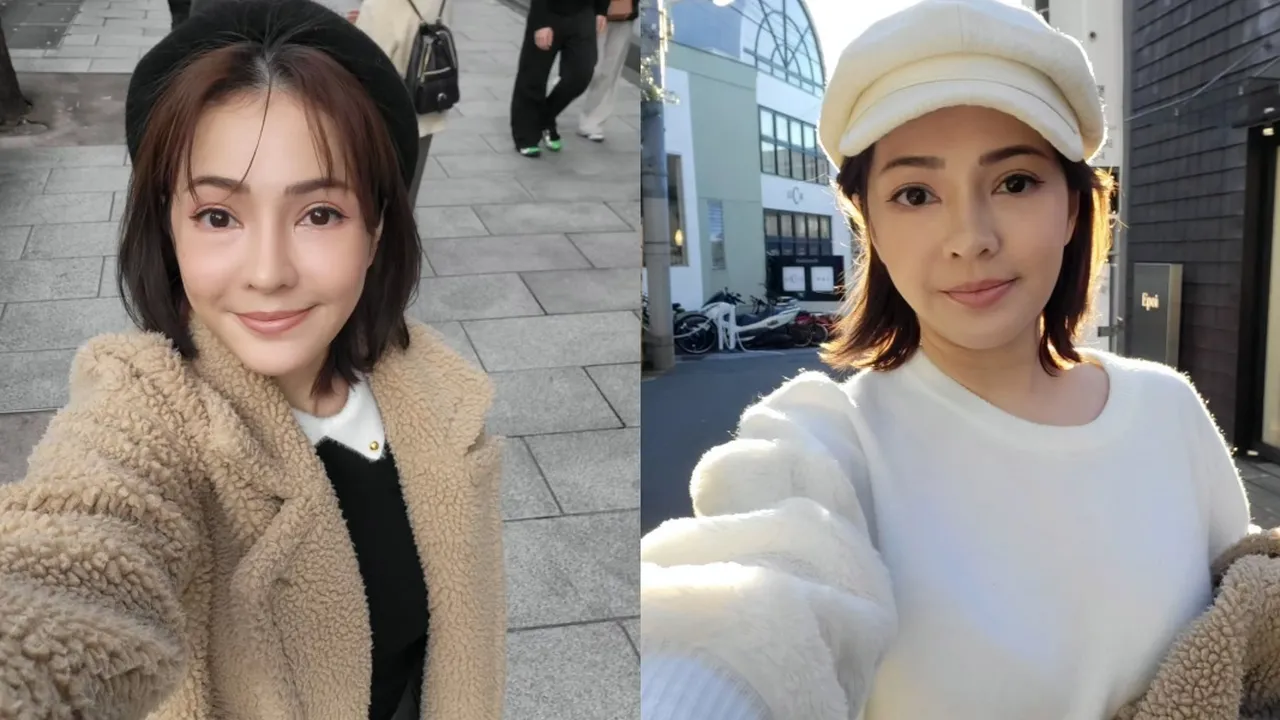 Maya Septha Cerita Pengalaman Oplas di Korea, Jalani Pemulihan yang Panjang