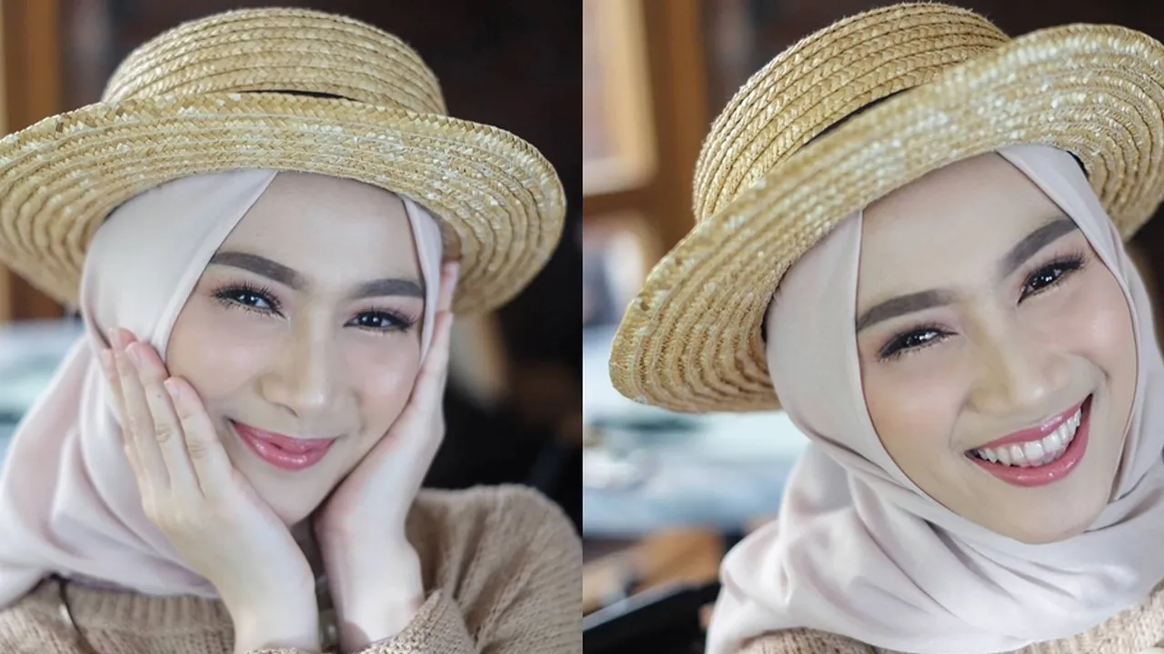 Melody Eks JKT48 Dilempar Kaleng Oleh Fans Sampai Nangis, Luka dan Memar