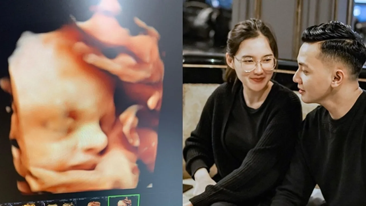 Nella Kharisma Unggah Foto USG, Hidung Sang Bayi Disebut Pasha Ungu Mirip Dory Harsa
