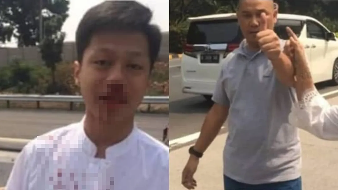 Oknum Plat Dengan Sticker TNI Pukuli Anak SMP Sampai Luka Parah, Alasannya Sepele