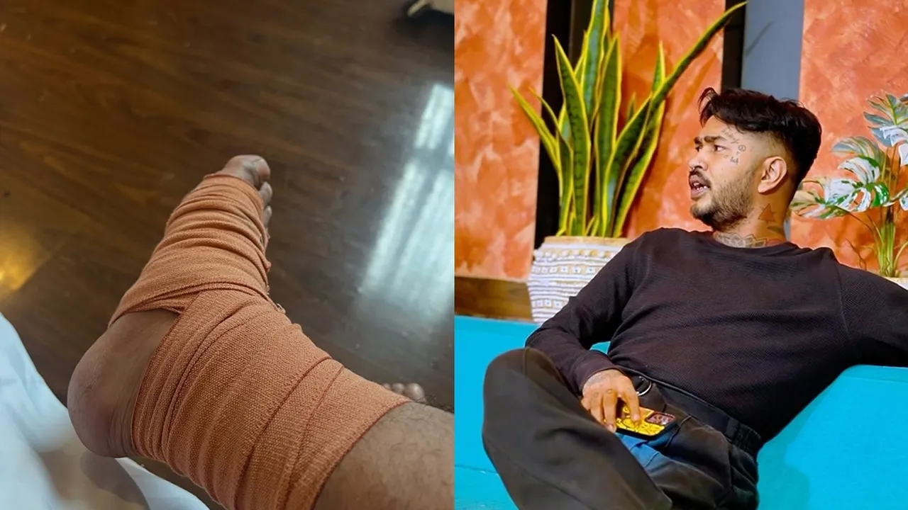 Onadio Leonardo Alami Insiden saat Manggung hingga Kakinya Diperban