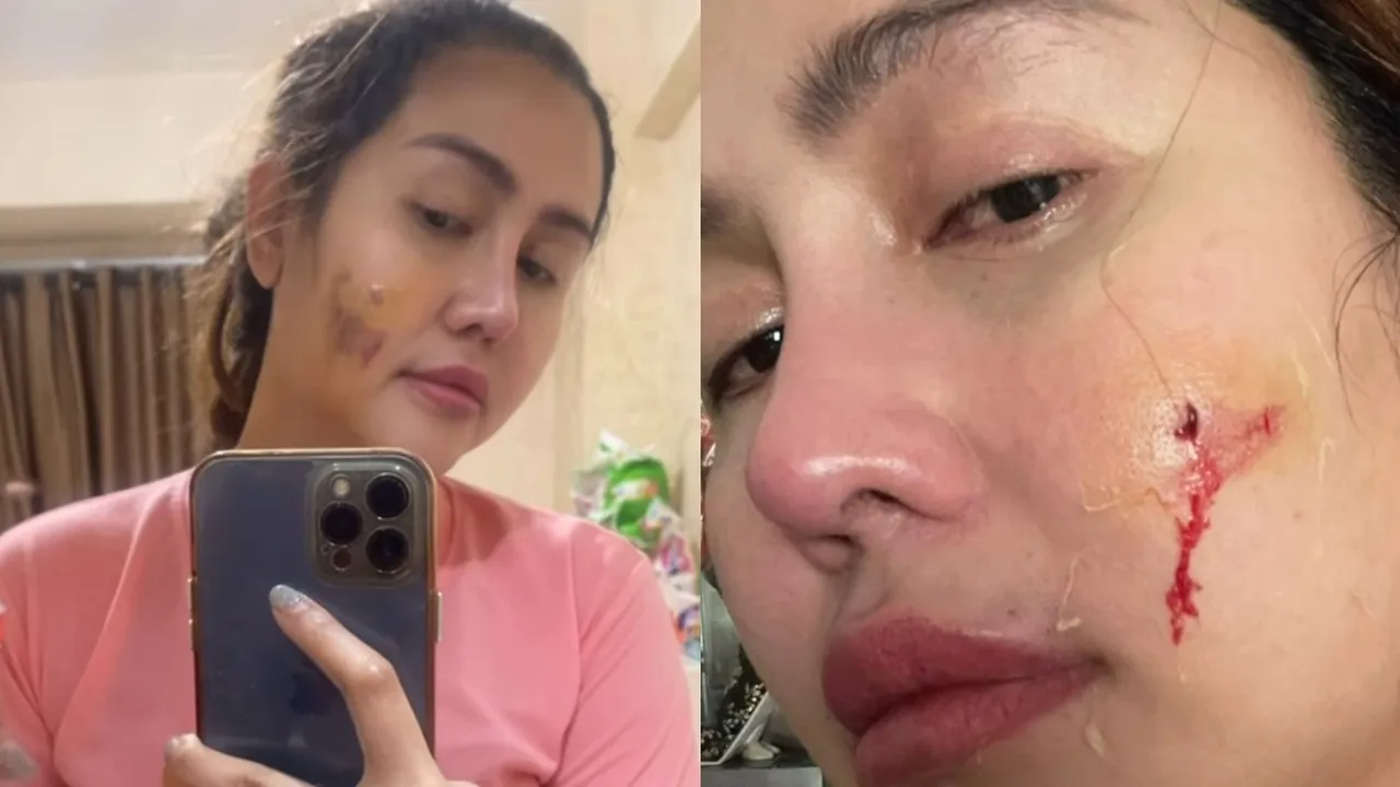 Pedangdut Ratu Meta Unggah Video Cekcok dengan Suami, Ungkap Kekerasan yang Diduga KDRT