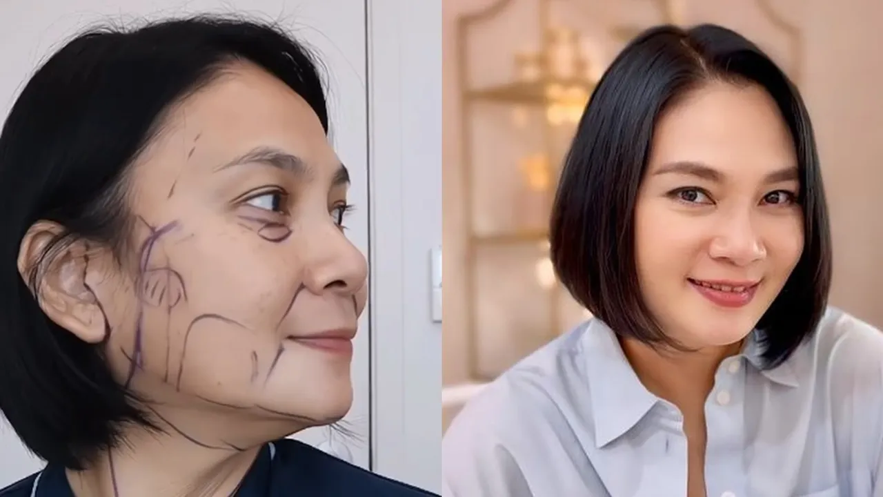 Perubahan Waktu ke Waktu Dian Nitami Setelah Oplas, Sudah Terlihat Hasilnya