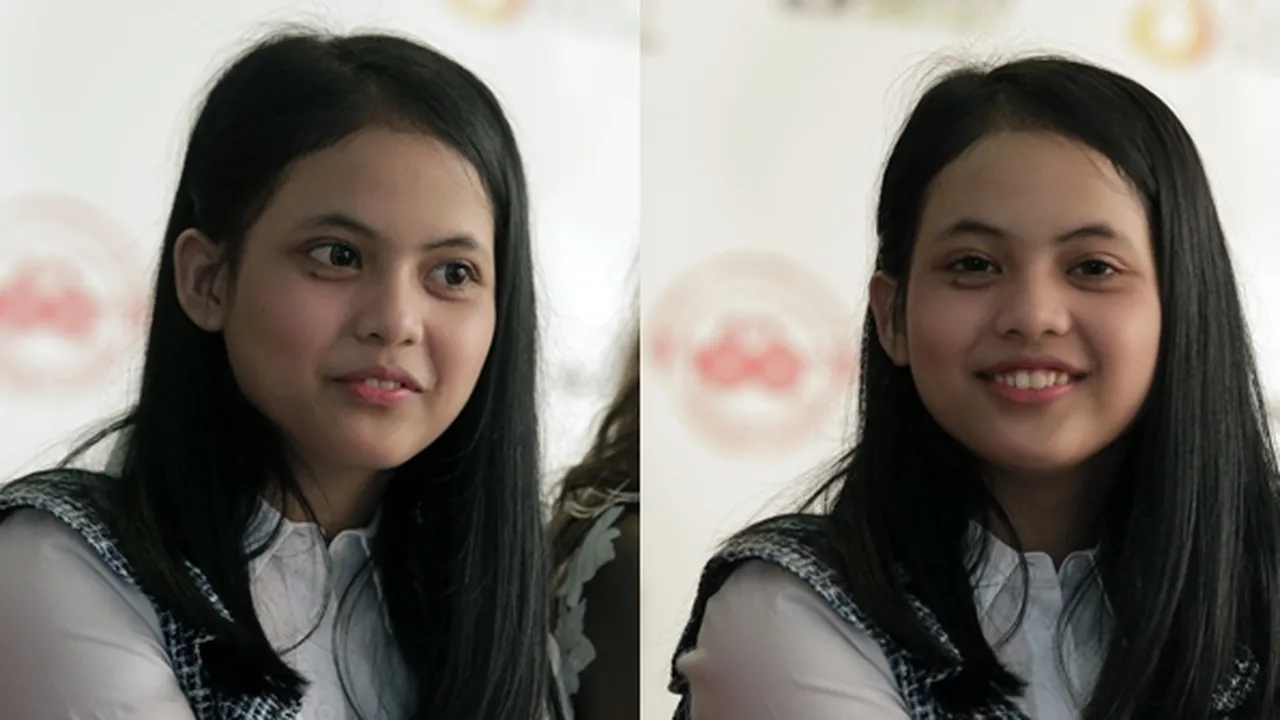 Pipi Memar Ketiban Handphone, Putri DA4 Tetap Sibuk Syuting FTV