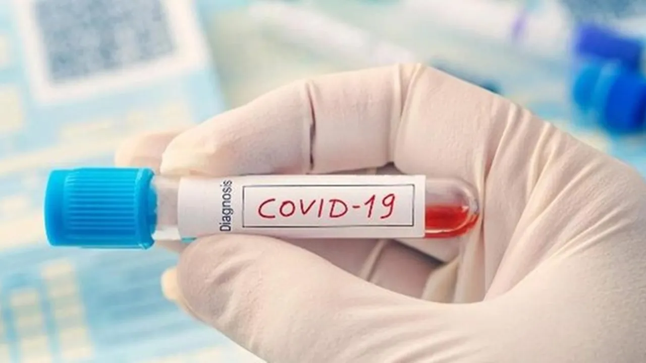 Positif Covid-19 Diduga Setelah Semeja di Hajatan Khitanan