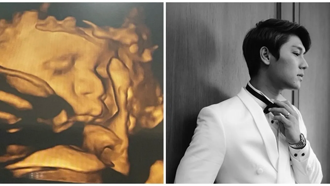 Potret Calon Bayi Lesti & Rizky Billar, Hidung Mancung Mirip Papanya Banget!