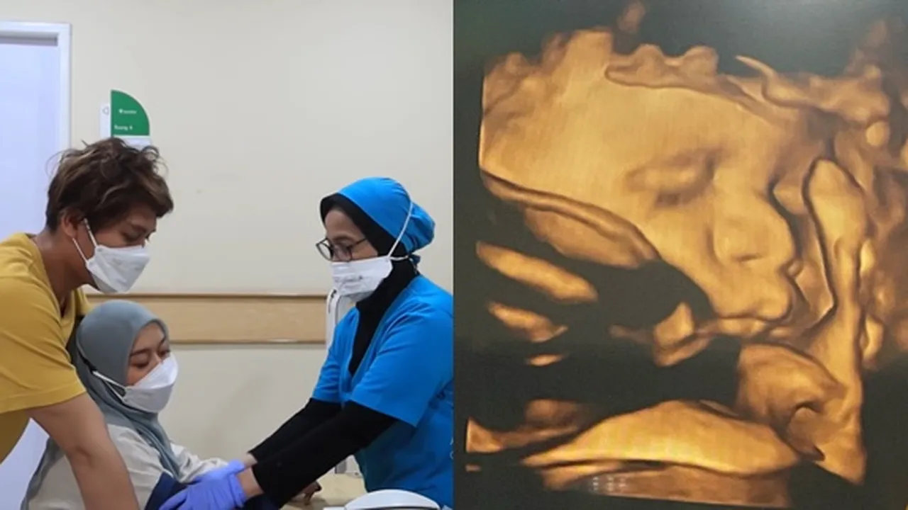 7 Potret Lesti Kejora Jalani USG Didampingi Rizky Billar, Dokter Berikan Prediksi Soal Postur Baby L