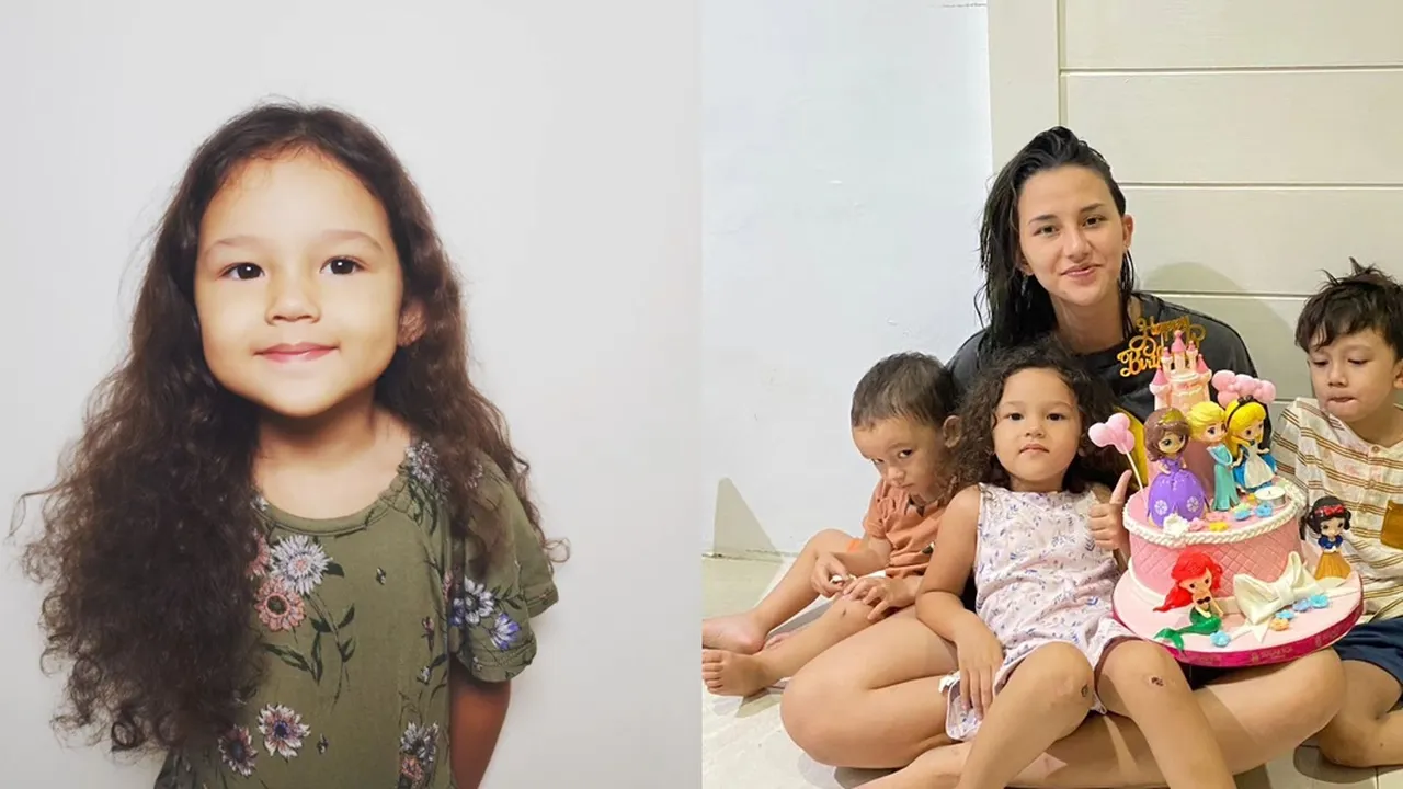 Potret Rose Anak Dahlia Poland dan Fandy Christian Rayakan Ultah, Ada Luka di Kedua Lututnya Jadi Sorotan