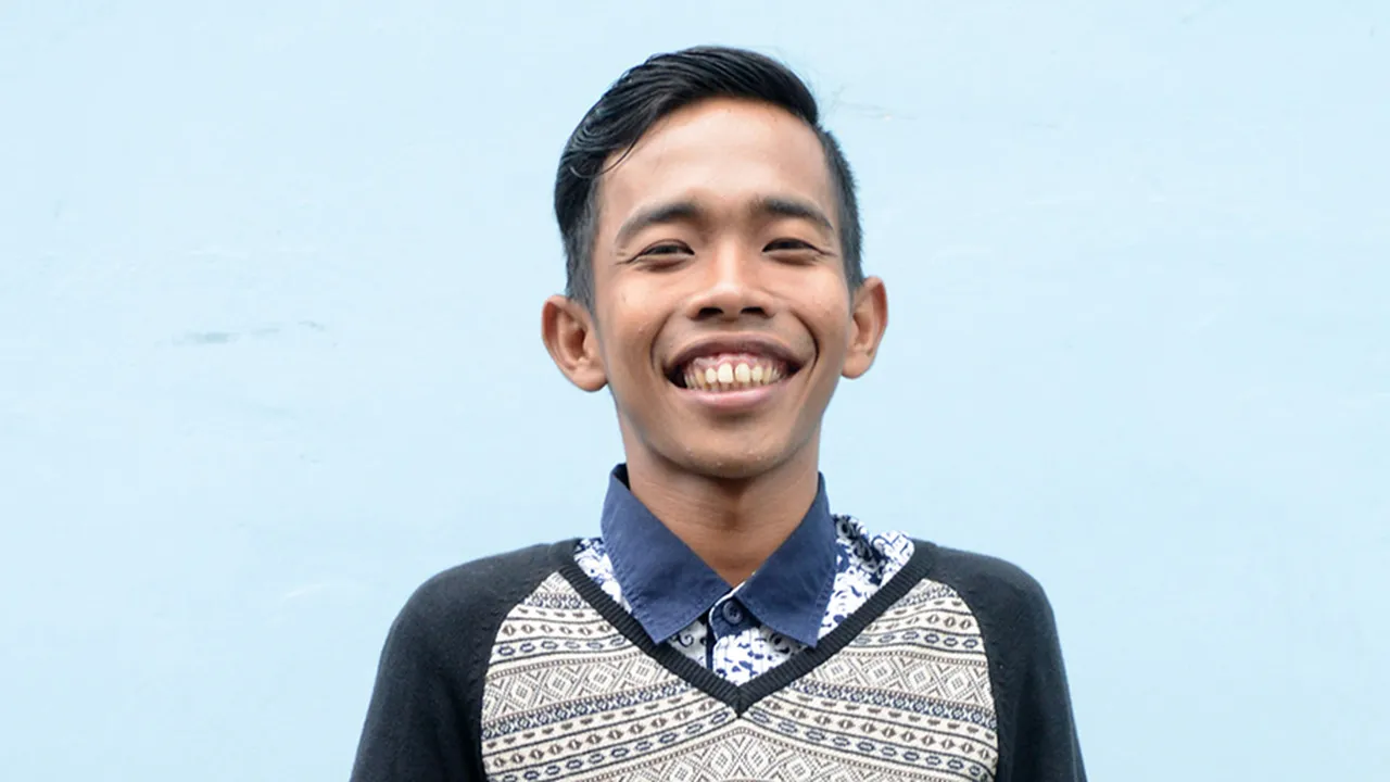 Putra Dede Sunandar Sudah Menigdap Williams Syndrome Sejak Usia 3 Bulan