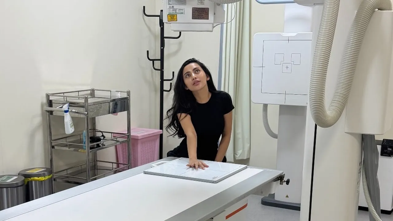 Rachel Vennya Alami Insiden Jari Manis Terjepit, Tangan Kiri Melepuh Kena Keju Panas