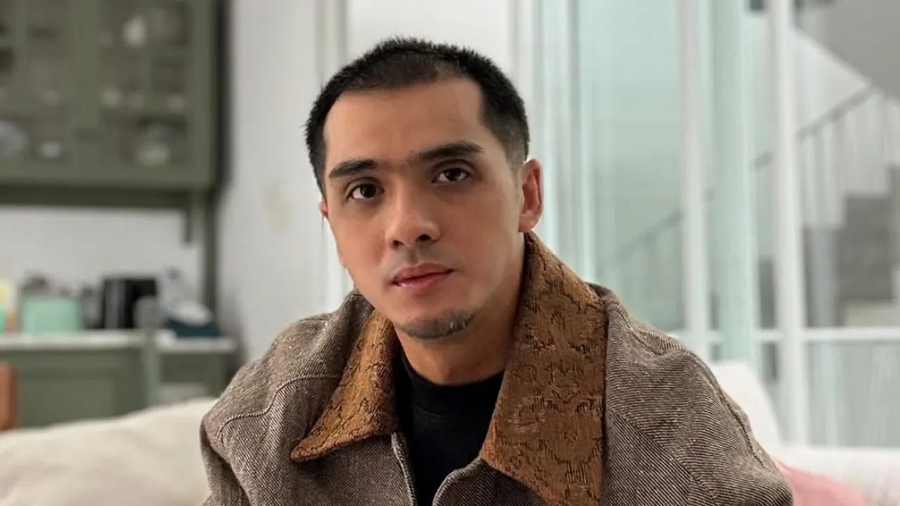 Ricky Harun Pernah Iritasi Kulit Parah, Ini Penyebabnya