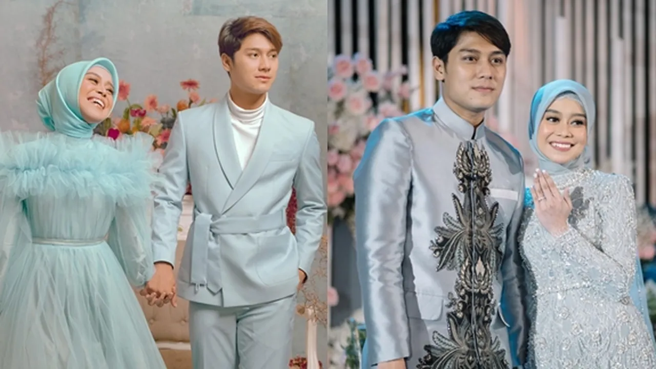 Rizky Billar Jalani Terapi Kaki Setelah Acara Lamaran dengan Lesti Kejora