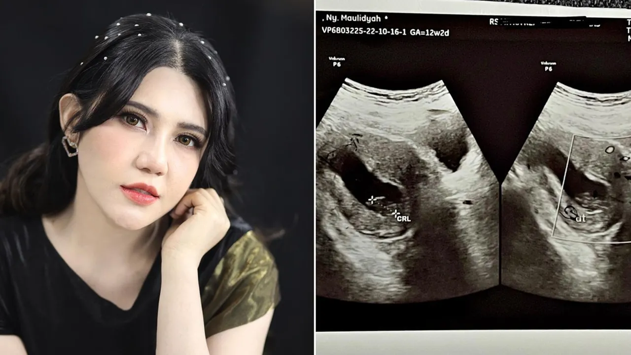 Sedih, Via Vallen Kembali Curhat Soal Janin yang Tak Berkembang