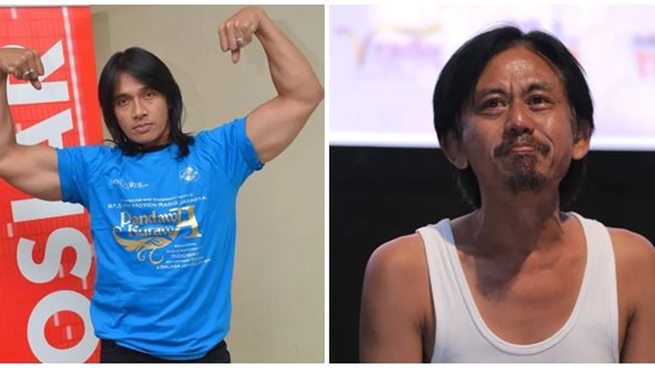 Selain Agung Hercules, 2 Seleb Tanah Air Ini Juga Terkena Penyakit Otak Selain Agung Hercules, 2 Seleb Tanah Air Ini Juga Terkena Penyakit Otak