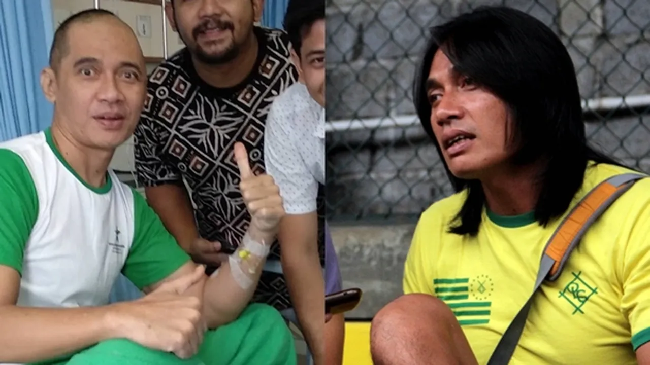Seputar Glioblastoma, Kanker Otak Yang Diderita Agung Hercules