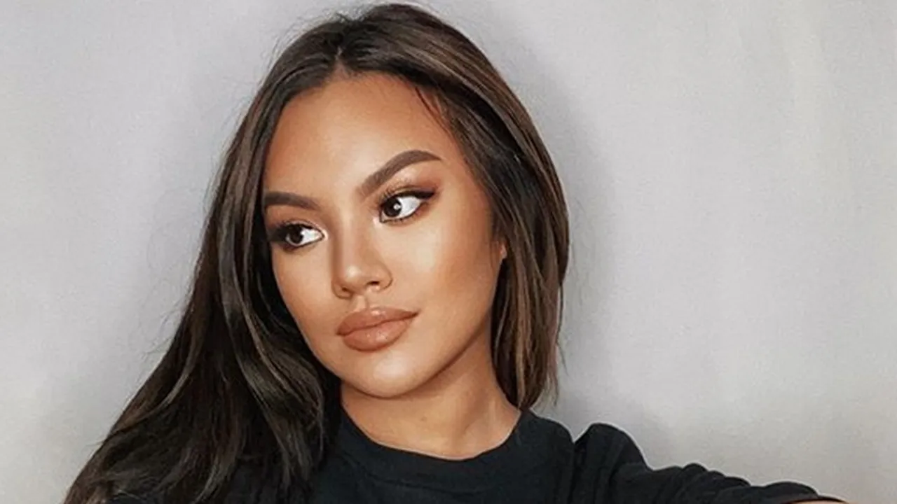 Shafa Harris Pamer Stretch Marks di Pahanya, Tunjukkan Sisi Body Positivity