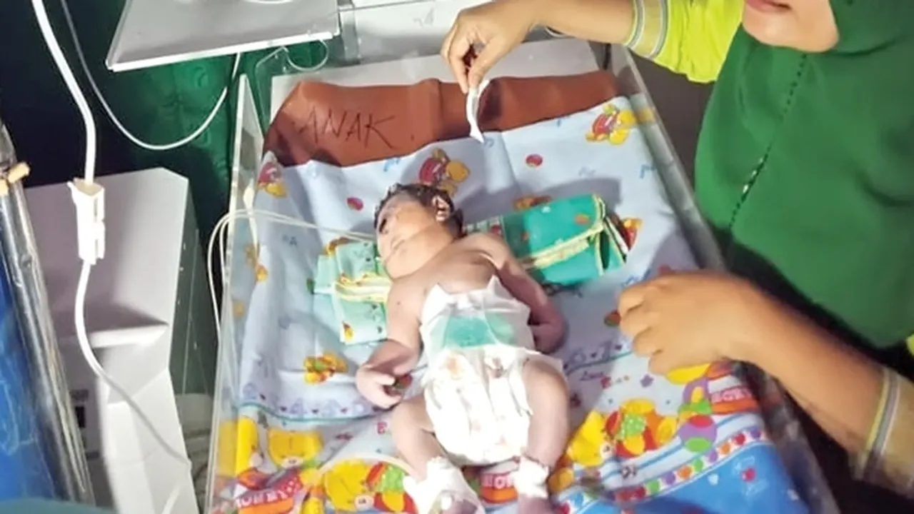 Tak Mampu Bertahan, Bayi Bermata Satu Meninggal Dunia Setelah Dirawat Selama 7 Jam