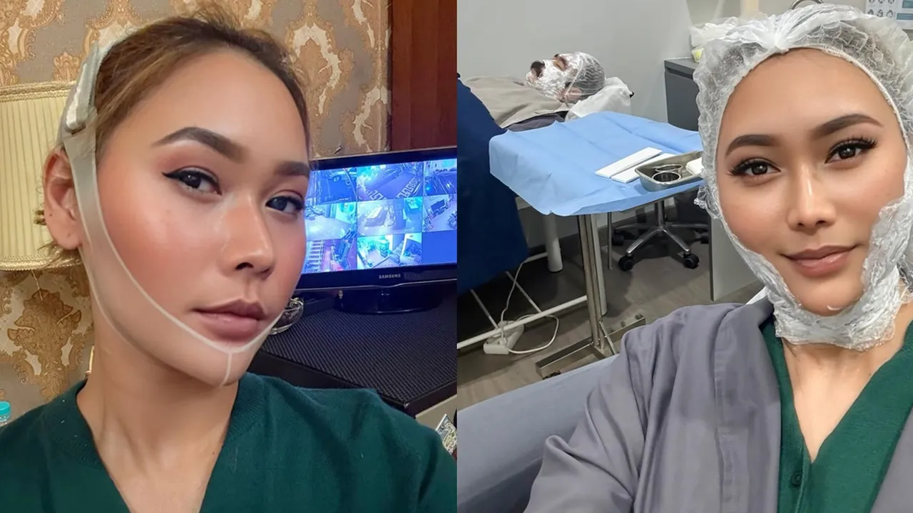 Tanpa Oplas, Inul Daratista Jalani Perawatan Ini untuk Wajah Tetap Tirus dan Awet Muda