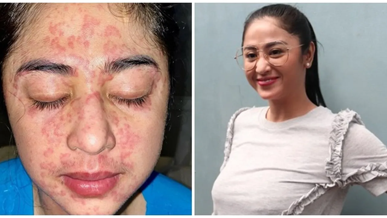 Terkena Covid & Sebulan Diisolasi, Dewi Perssik Sempat Merasa Stres