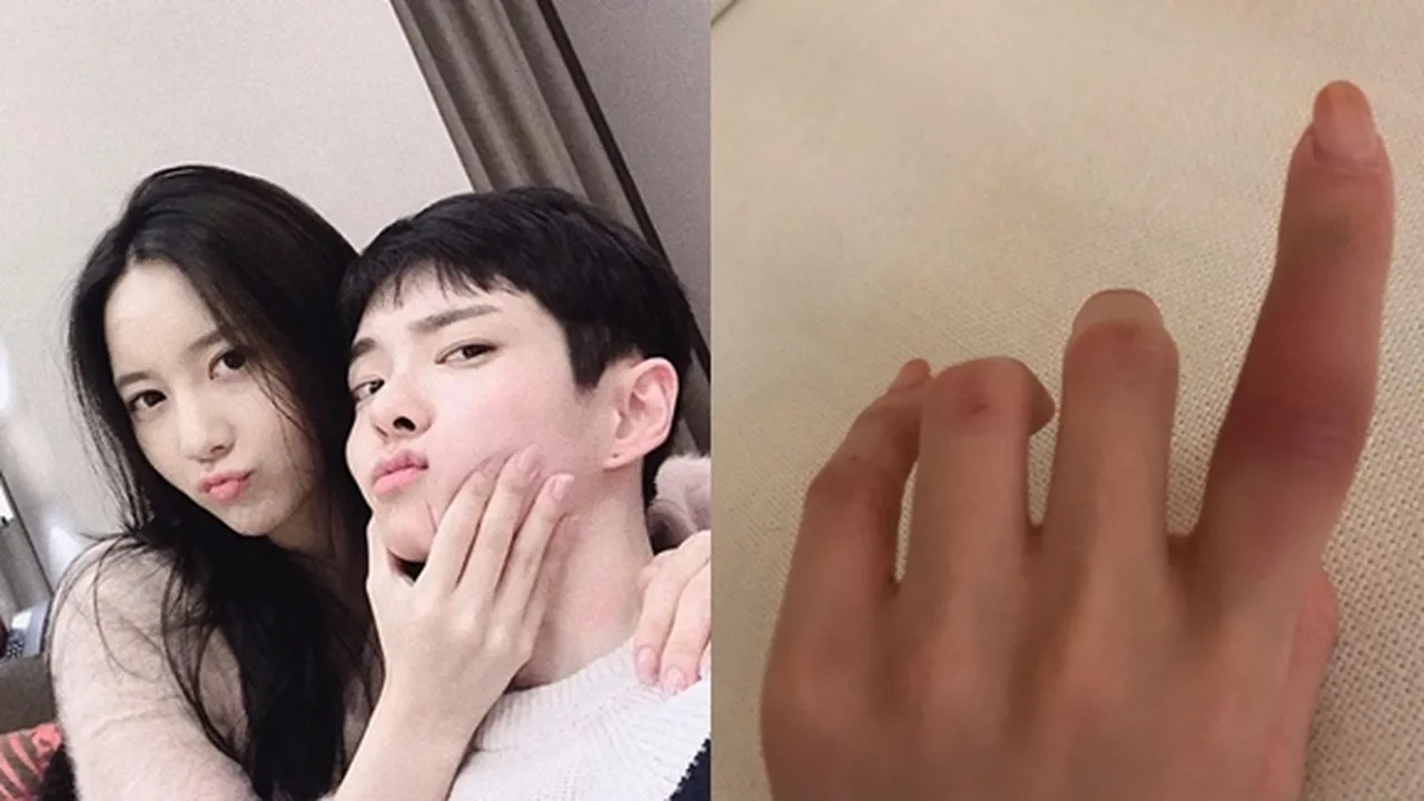Usai Mengaku Hampir Dibunuh, Han Seo Hee Unggah Fotro Tangan Memar
