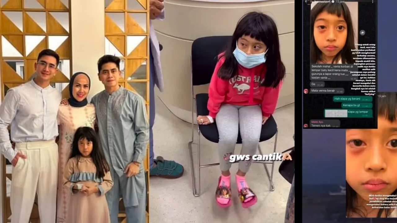 Vania Adik Verrell Bramasta Jadi Korban Bully, Mata Dilempar Sampai Bengkak Vania Adik Verrell Bramasta Jadi Korban Bully, Mata Dilempar Sampai Bengkak