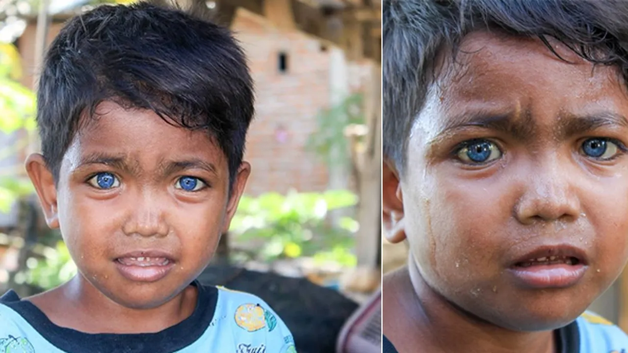 Viral! Bocah Bermata Biru Asal Sulawesi Ini Dikira Pakai Softlens Ternyata Asli