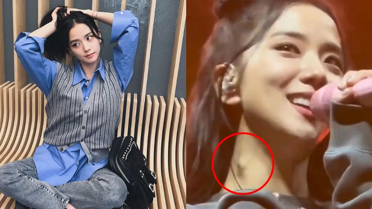 YG Entertainment Berikan Respon Terhadap Benjolan di Leher Jisoo BLACKPINK, Sebut Kesehatannya Baik-baik Saja
