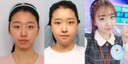 Gadis Korea Tinggal di Indonesia Ungkap Pengalaman Oplas (Part 2)