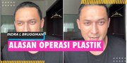 Indra L Bruggman Ungkap Alasan Lakukan Operasi Plastik di Korea Selatan