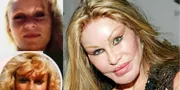 Jocelyn Wildenstein 'Catwoman' Meninggal Dunia, Sosialita Asal Swiss Penggila Operasi Plastik
