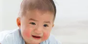 Mengenal Ciri Kuning pada Bayi: Gejala, Penyebab, dan Cara Penanganannya