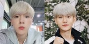 Foto Baekhyun EXO dengan Rambut Putih Hasil Polling 500 Ribu Fans di Twitter, Kelihatan Makin Muda