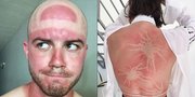 Foto-Foto Ini Buktikan Matahari Sebagai Ahli Tattoo Yang Ngeri!