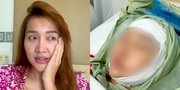 Proses Lucinta Luna Ganti Kepala Alias Operasi Plastik, Baru Kelihatan Hasil di Mata Tapi Udah Disebut Mirip Lisa BLACKPINK