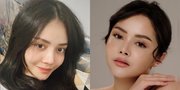 Wajah dan Hidungnya Sempat Disebut Aneh, Ini 8 Potret Terbaru Mawar AFI yang Makin Cantik Bak ABG - Netizen Sebut Ada yang Nyesel