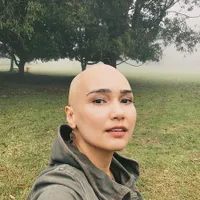 10 Foto Feby Febiola yang Tetap Cantik dengan Kepala Plontos Usai Lawan Kanker Ovarium